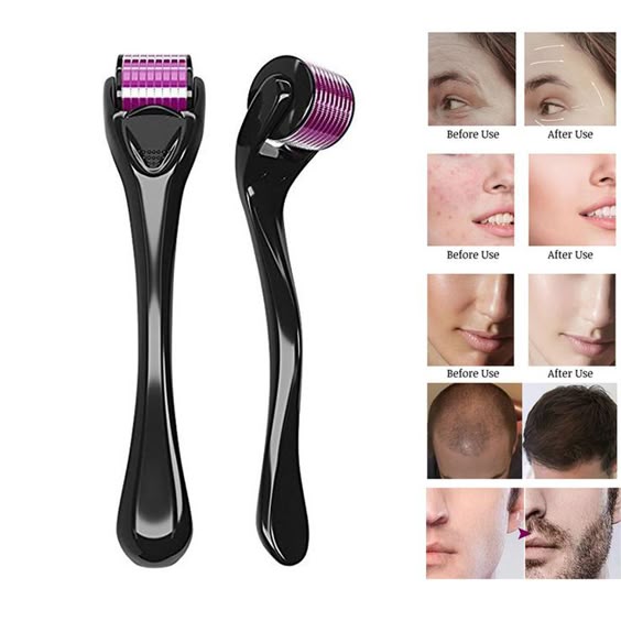 FEG beauty Hair Regrowth Kit